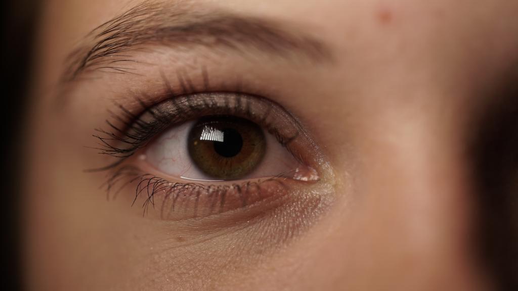 Dark circles under the eyes – DermaHealth