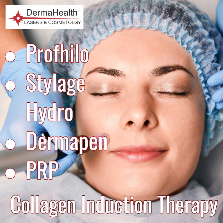 What is Collagen Induction Therapy? DermaHealth