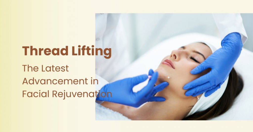 Thread Lifting: The Latest Advancement in Facial Rejuvenation – DermaHealth